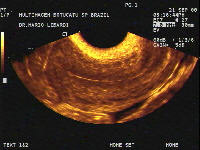 Diagnostic Medical Sonography Images