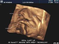 Diagnostic Medical Sonography Images